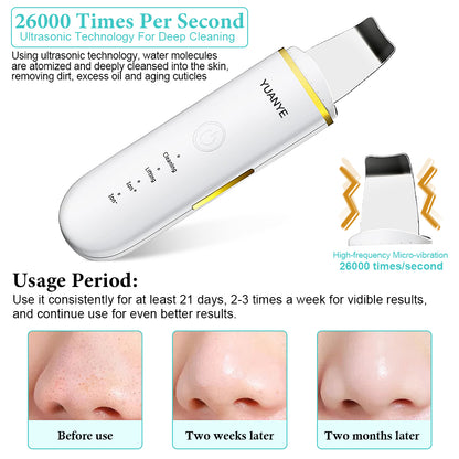 4-Mode Face Spatula: Pore Cleaner & Blackhead Remover for Deep Facial Cleansing